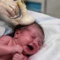 Newborn head injuries after vacuum extraction: Identifying scalp swelling, bleeding, and serious birth complications